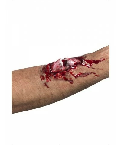 Broken Bone Scar