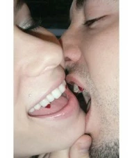 Dental Fix Blood Tipped Fangs